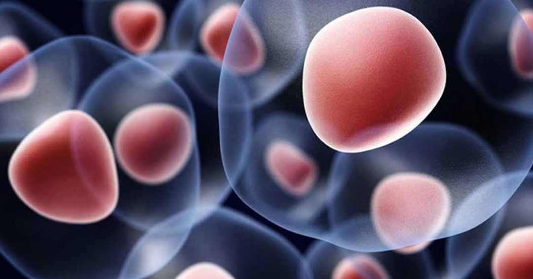 StemCell Therapy Vs Autism Spectrum Disorder MHF Kolkata StemCell Therapy Vs Autism Spectrum Disorder MHF Kolkata